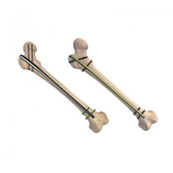 股骨髓內(nèi)釘（X系列專(zhuān)家級(jí)）